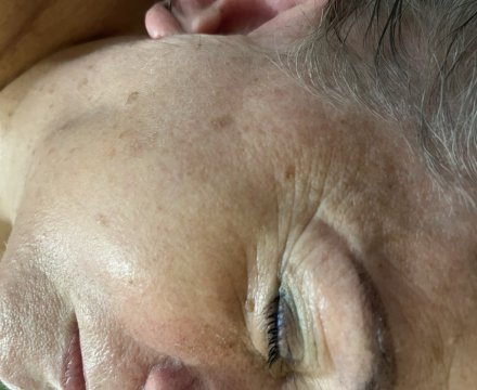 Fotografie po úpravě