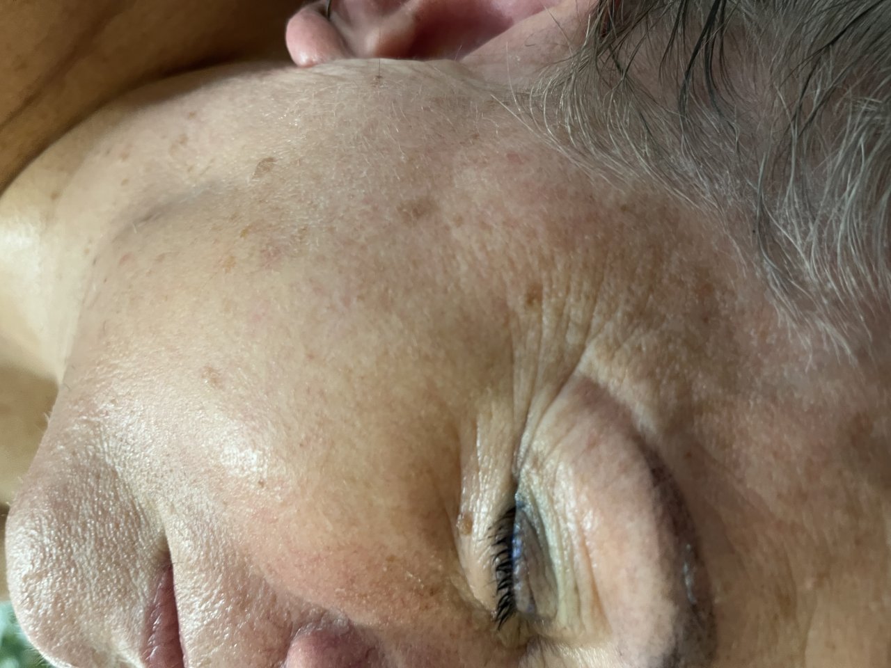 Fotografie po úpravě